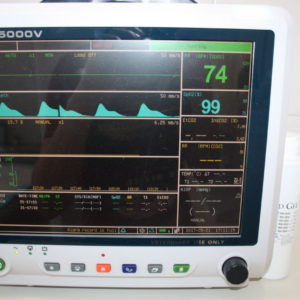 monitoring anestzie – EKG, saturace O2, CO2, počty dechů, teplota, tlak krve